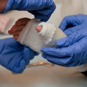 To par blå hanskekledde hender bandasjerer en hånd