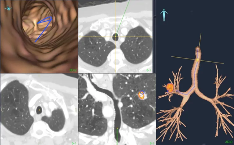 En collage av forskjellige bilder