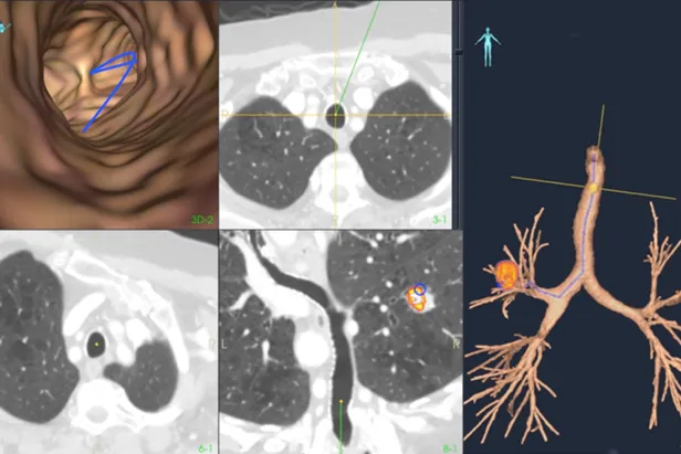 En collage av forskjellige bilder